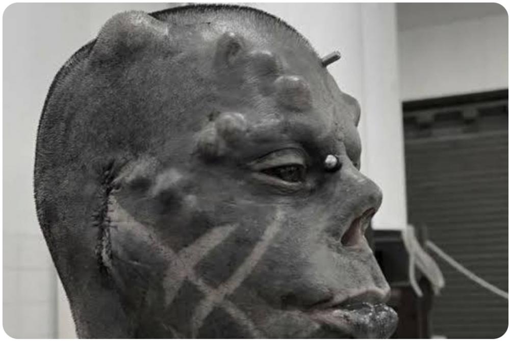 Diabão explica se consegue ouvir e como usar óculos após remover as orelhas