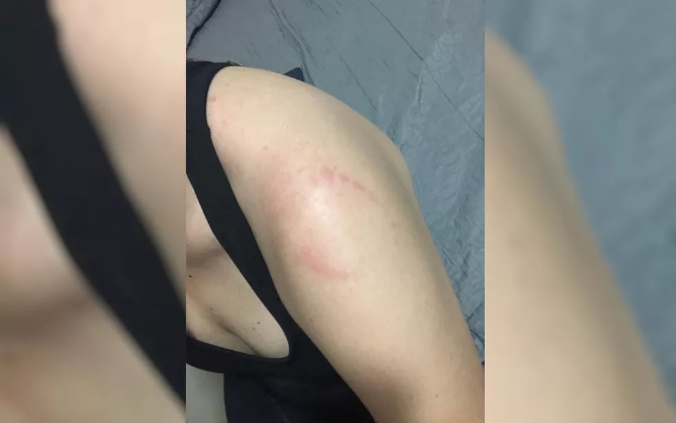 Após tomar pré-treino vencido, maromba surta e morde mulher na academia; veja vídeo