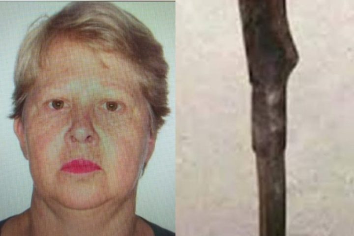 Esposa sacrifica o próprio braço ao entrar na frente de golpe de foice para salvar marido