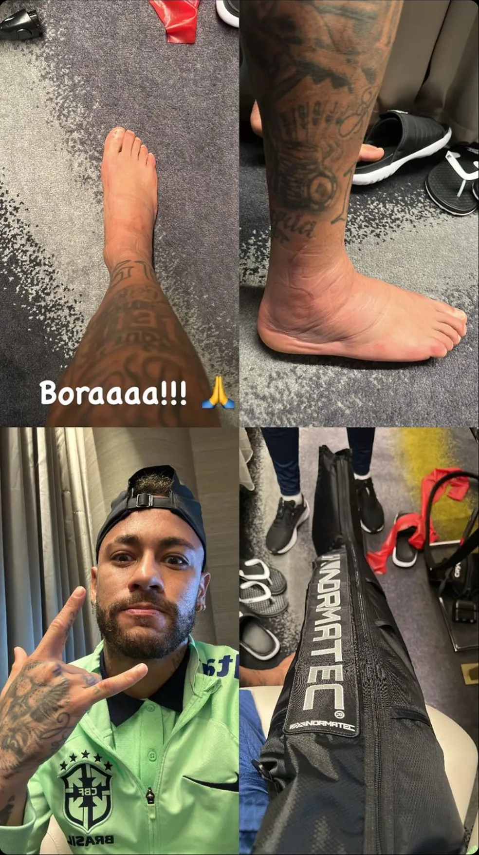 Neymar posta foto de tornozelo inchado durante tratamento na Seleção: 